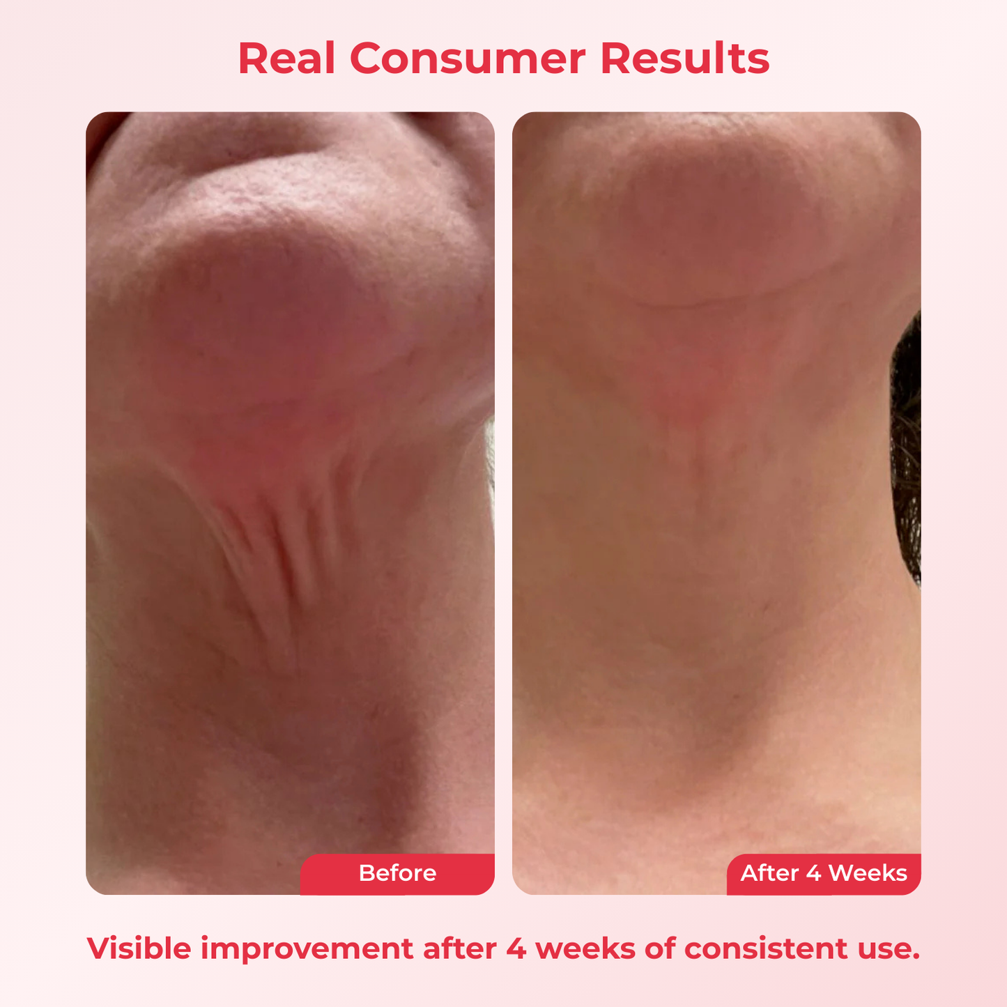 Koriderm™ Time Reverse Neck Cream