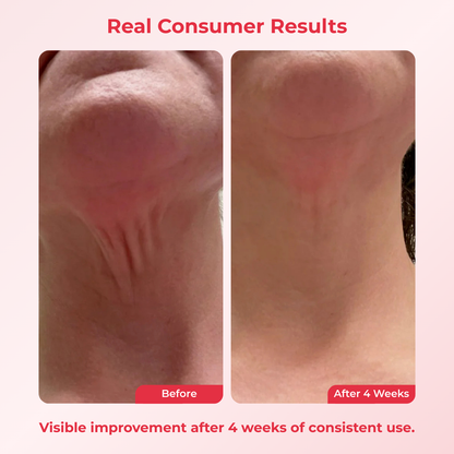 Koriderm™ Time Reverse Neck Cream
