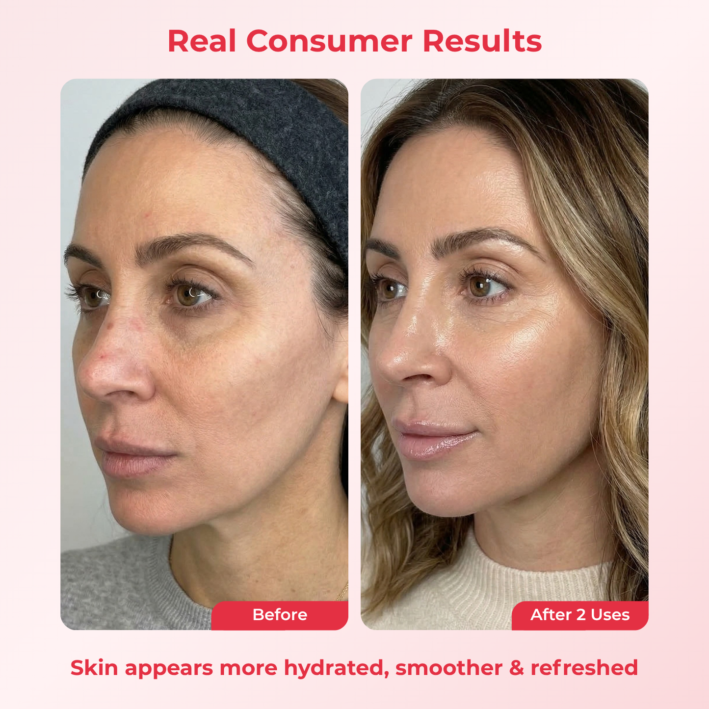 PDRN Deep Mask (4 Masks)